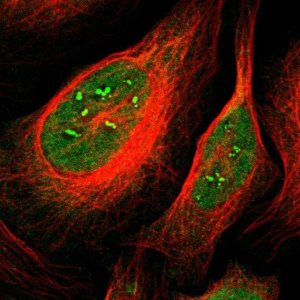 Anti-CAMK4 antibody produced in rabbit HPA011753-100UL