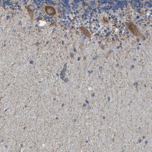 Anti-CAMKK2 antibody produced in rabbit 