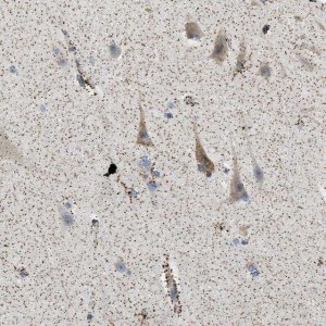 Anti-CAMKK2 antibody produced in rabbit 