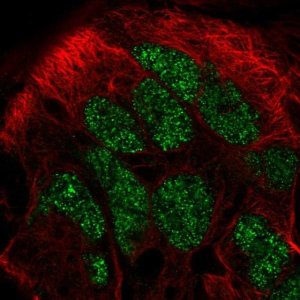 Anti-CAMKMT antibody produced in rabbit 