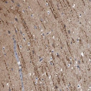 Anti-CAMSAP1 antibody produced in rabbit 