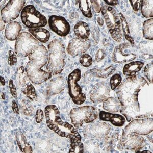Anti-CAND2 antibody produced in rabbit 