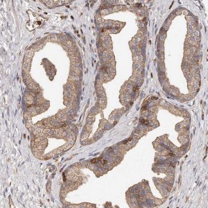 Anti-CAP1 antibody produced in rabbit HPA030124-100UL