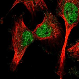 Anti-CAPN10 antibody produced in rabbit 