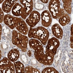 Anti-CAPN15 antibody produced in rabbit 