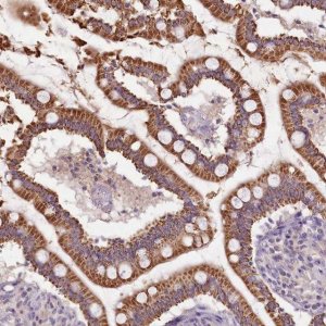 Anti-CAPN7 antibody produced in rabbit 