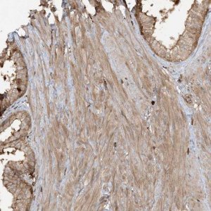 Anti-CAPZB antibody produced in rabbit 