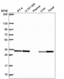 Anti-CAPZB antibody produced in rabbit HPA056066-100UL