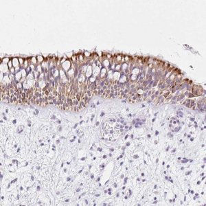 Anti-CARD16 antibody produced in rabbit 