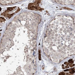 Anti-CARD6 antibody produced in rabbit 