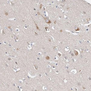 Anti-CARMIL3 antibody produced in rabbit 