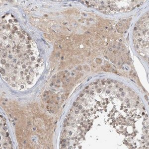 Anti-CARMIL3 antibody produced in rabbit 