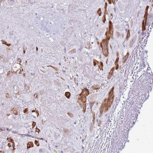 Anti-CASD1 antibody produced in rabbit 