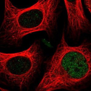 Anti-CASD1 antibody produced in rabbit 