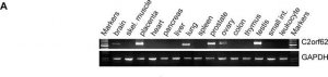Anti-CATIP antibody produced in rabbit 