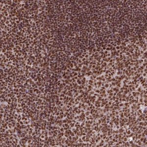 Anti-CCAR1 antibody produced in rabbit 