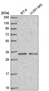 Anti-CCDC107 antibody produced in rabbit HPA050442-100UL