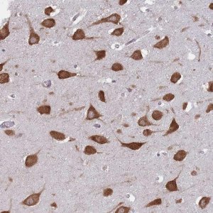 Anti-CCDC124 antibody produced in rabbit 