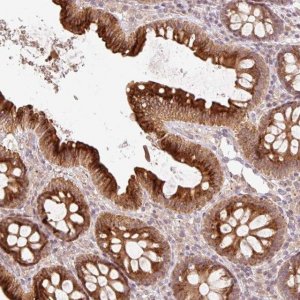 Anti-CCDC130 antibody produced in rabbit 
