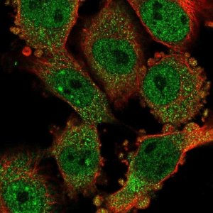 Anti-CCDC159 antibody produced in rabbit 