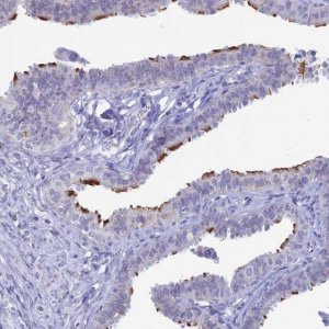 Anti-CCDC173 antibody produced in rabbit 