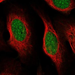 Anti-CCDC175 antibody produced in rabbit 