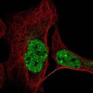Anti-CCDC188 antibody produced in rabbit 