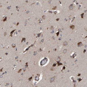 Anti-CCDC25 antibody produced in rabbit HPA023256-100UL