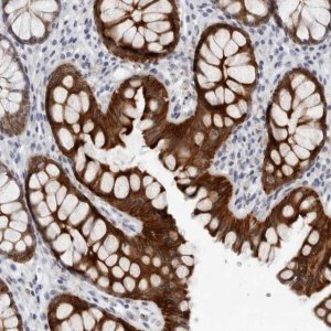 Anti-CCDC28B antibody produced in rabbit 