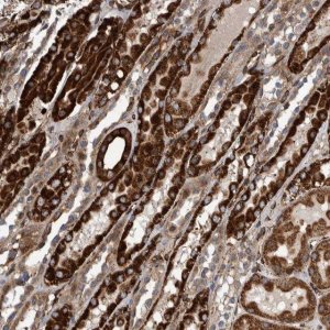 Anti-CCDC57 antibody produced in rabbit 