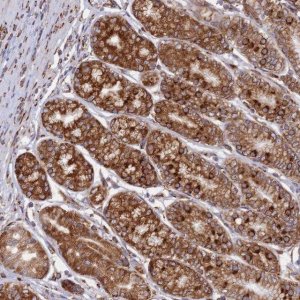 Anti-CCDC69 antibody produced in rabbit 