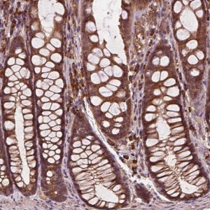 Anti-CCDC71L antibody produced in rabbit 