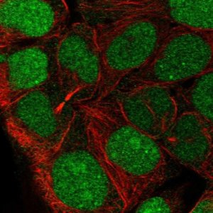 Anti-CCDC84 antibody produced in rabbit 