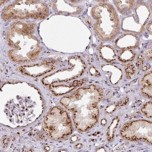 Anti-CCDC85B antibody produced in rabbit 