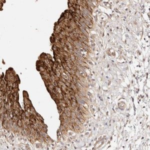 Anti-CCL14 antibody produced in rabbit 