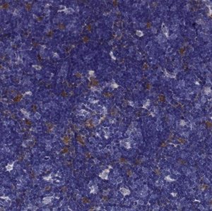 Anti-CCR8 antibody produced in rabbit 