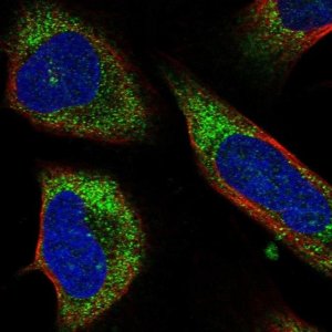 Anti-CCZ1 antibody produced in rabbit 