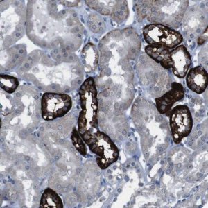 Anti-CDH22 antibody produced in rabbit 