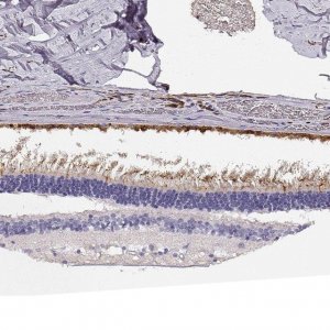 Anti-CDHR1 antibody produced in rabbit 