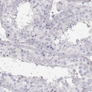 Anti-CDHR1 antibody produced in rabbit 