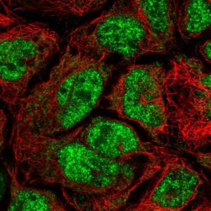 Anti-CDK5RAP1 antibody produced in rabbit 