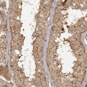 Anti-CDK5RAP2 antibody produced in rabbit 