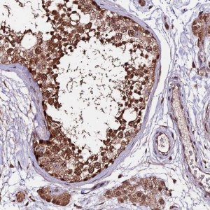 Anti-CDKN2AIP antibody produced in rabbit HPA041397-100UL
