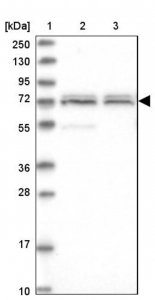 Anti-CDKN2AIP antibody produced in rabbit HPA041397-100UL