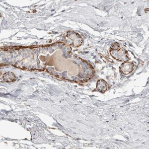 Anti-CDR2 antibody produced in rabbit 