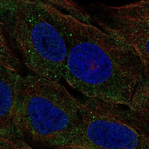 Anti-CELA3A antibody produced in rabbit 