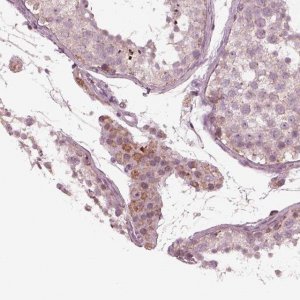Anti-CELSR3 antibody produced in rabbit 