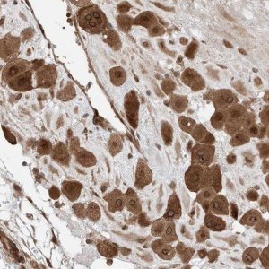 Anti-CEP162 antibody produced in rabbit 