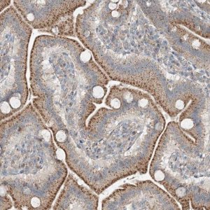 Anti-CEP162 antibody produced in rabbit 