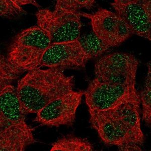 Anti-CERS6 antibody produced in rabbit 
